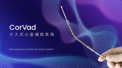 國產(chǎn)創(chuàng)新突破 深企介入式心室輔助系統(tǒng)獲批上市，填補(bǔ)國內(nèi)技術(shù)空白